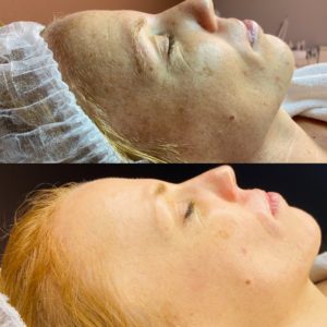 A52D1533-1871-41D4-84CF-36D8C82AF1DF-min