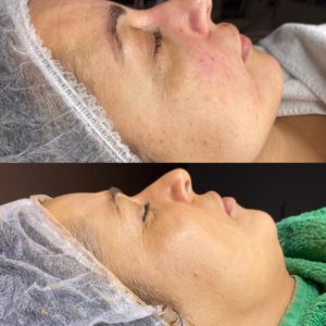 FA6E4119-8ED0-412B-9117-A967457FCD95-min